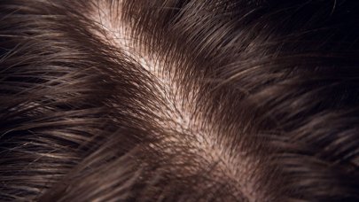 Cabello y cuero cabelludo normales